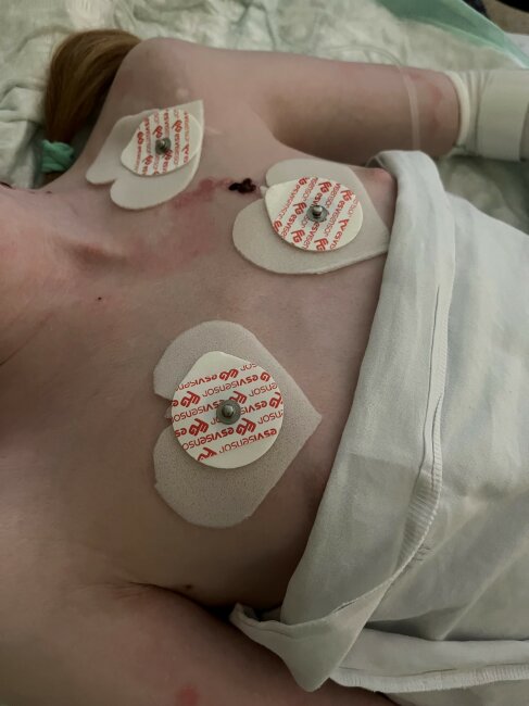 Kožní_EKG elektrody II